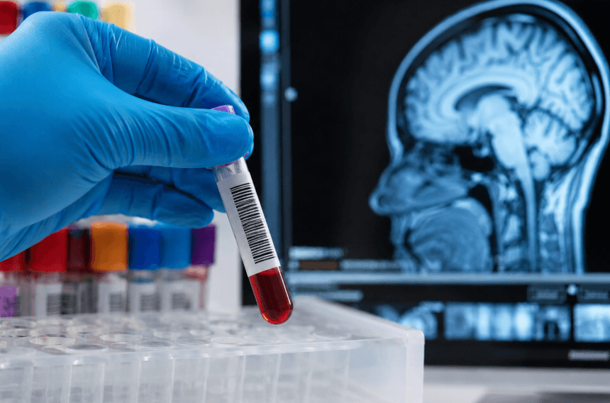 Blood Proteins May Predict Multiple Sclerosis Years Before Diagnosis, Study Finds Blood Proteins May Predict Multiple Sclerosis Years Before Diagnosis, Study Finds